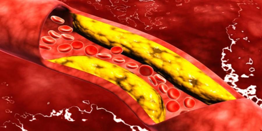 7 عادات يومية لخفض مستويات الكوليسترول بشكل طبيعي - شبكة أطلس سبورت